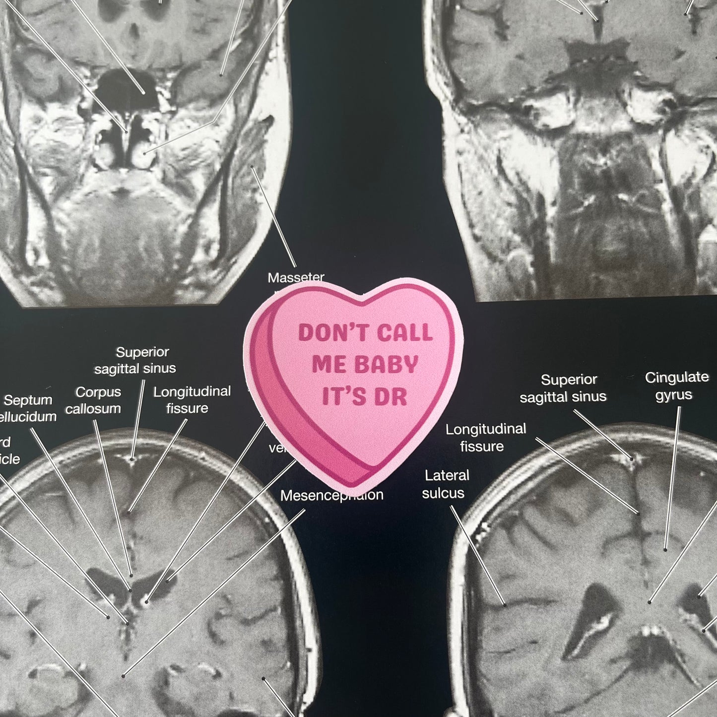 it's dr 4.5 x 4.5 cm